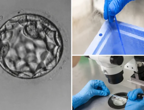When to think of ‘Embryo freezing’?