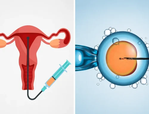 Intra uterine insemination (IUI) Vs In-vitro Fertilization (IVF)?
