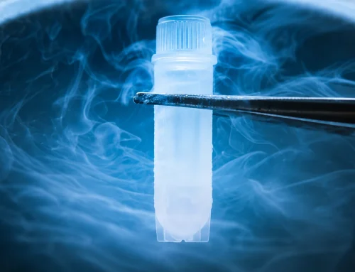 Why doctors suggests for semen freezing?