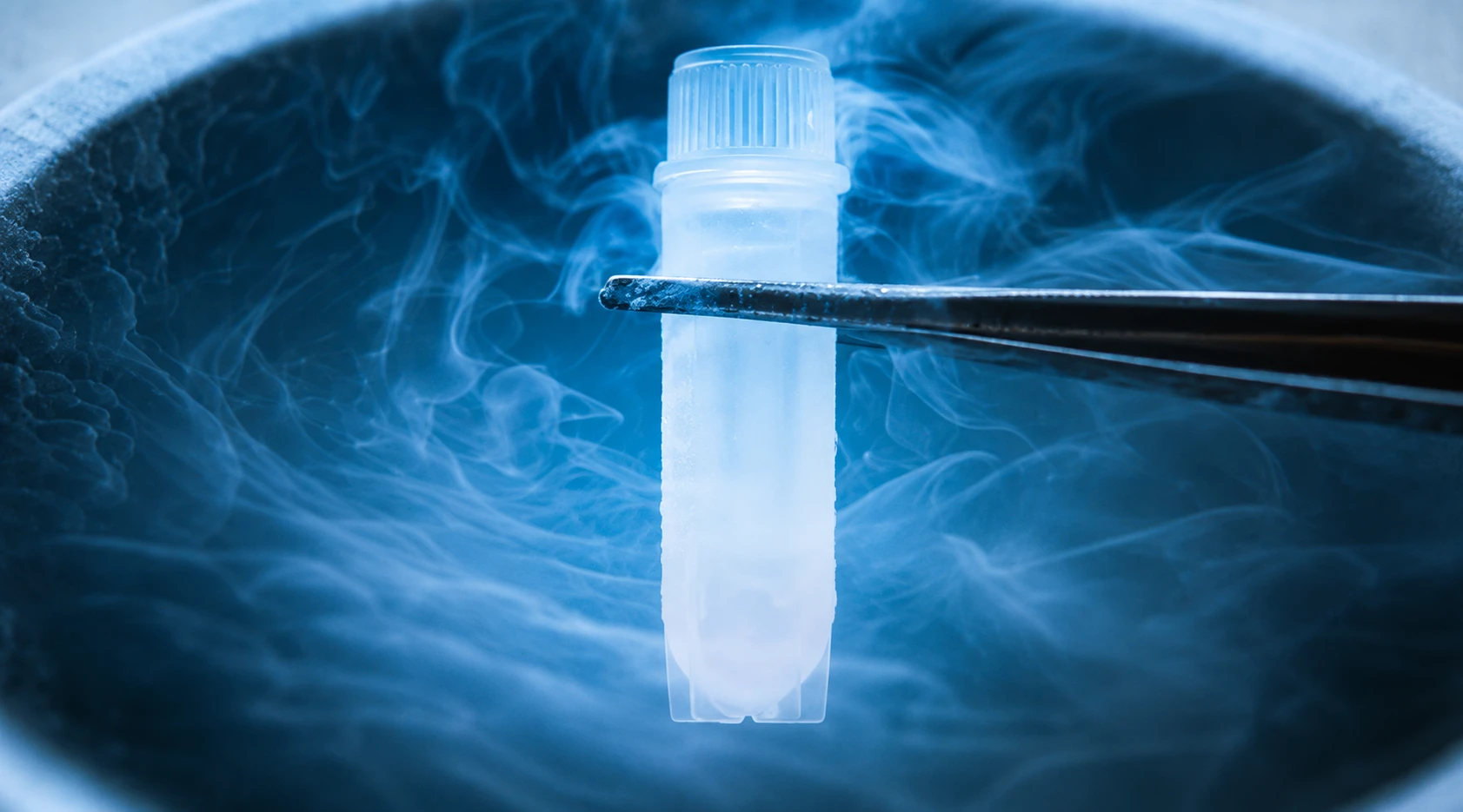 Semen freezing sample stored in cryogenic conditions for fertility preservation and future reproductive treatment