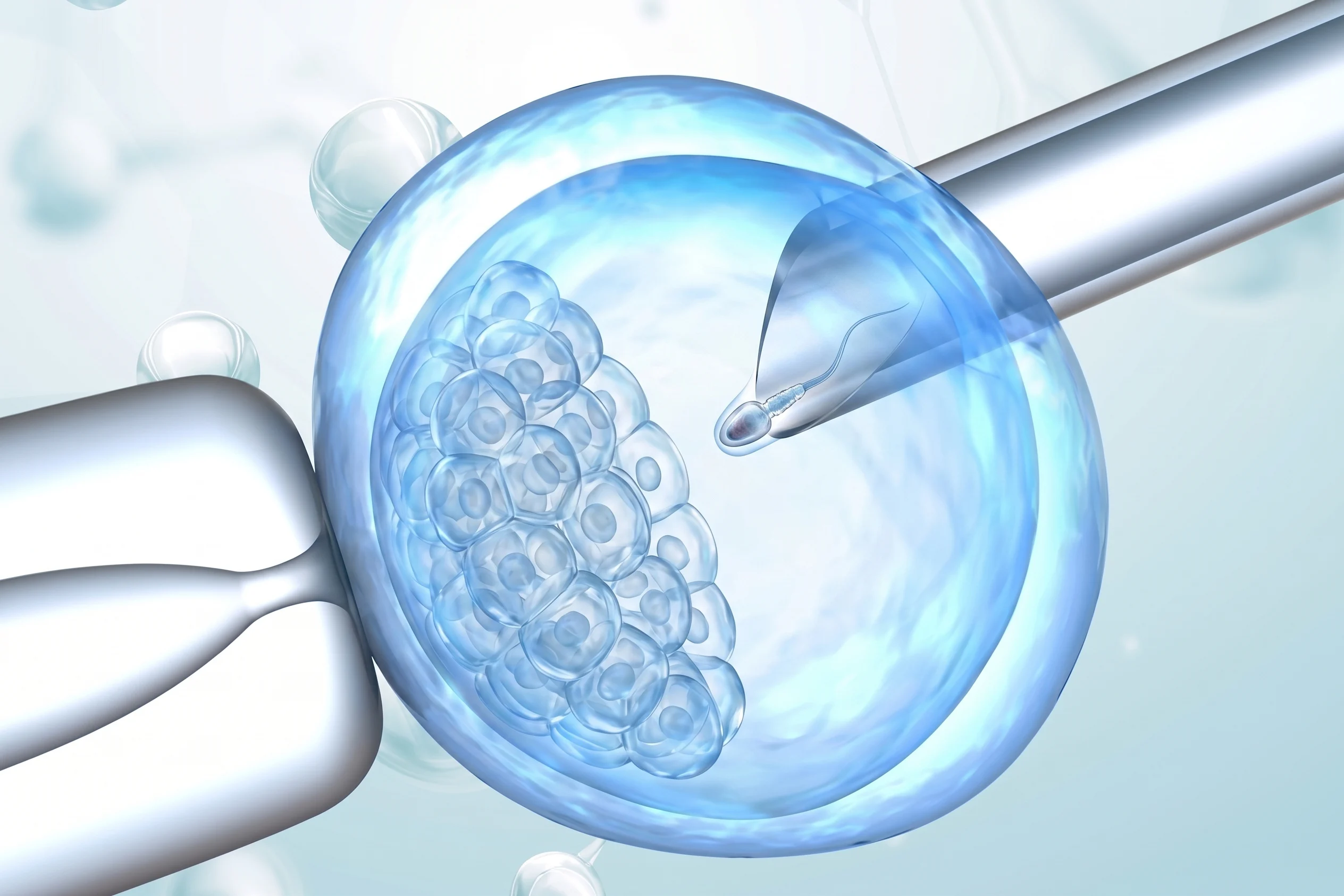 Laser-Assisted Hatching procedure in IVF showing precision laser technology used to help an embryo hatch before implantation and improve pregnancy success.